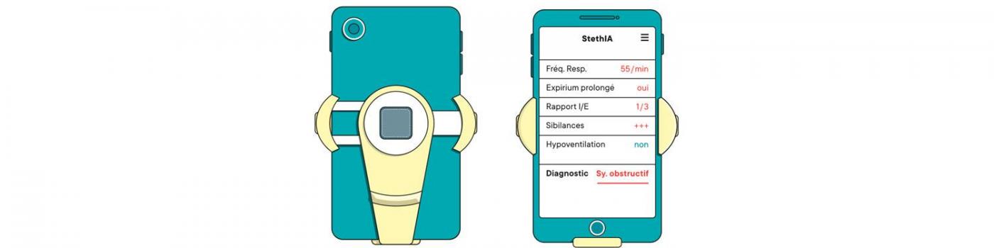 Stéthoscope 2.0