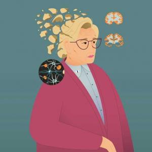 illustration : la maladie d’Alzheimer