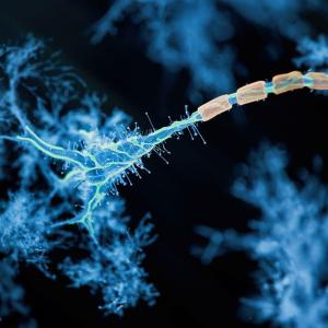 Espoir pour la sclérose en plaques