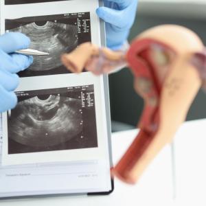 analyse d'une echographie