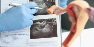 analyse d'une echographie